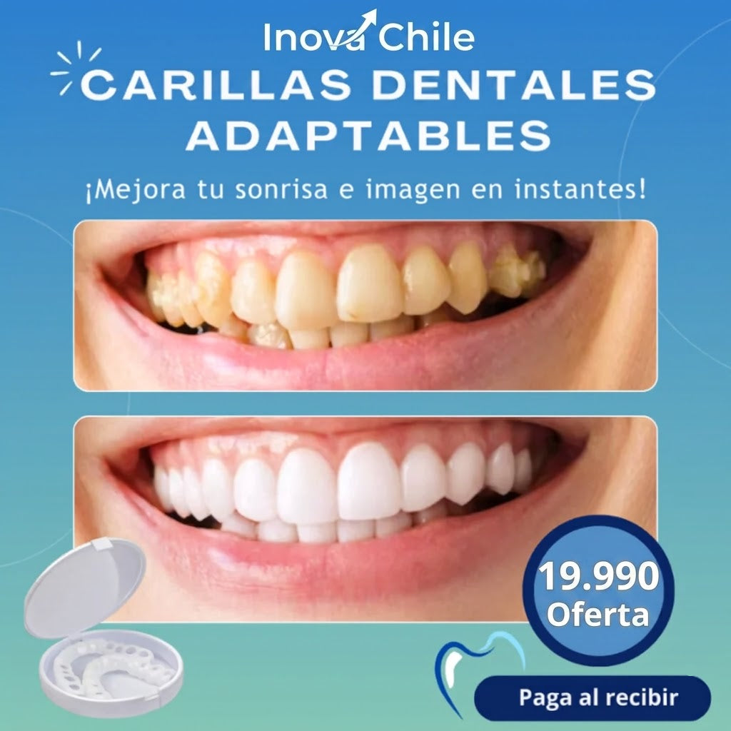 Carillas Dentales Adaptables - Transforma tu Sonrisa