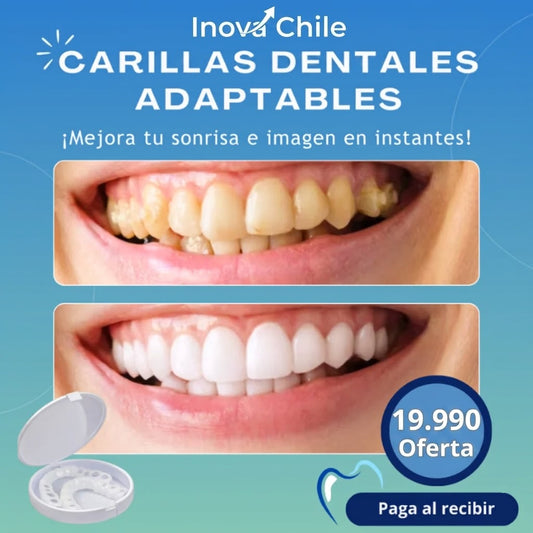 Carillas Dentales Adaptables - Transforma tu Sonrisa